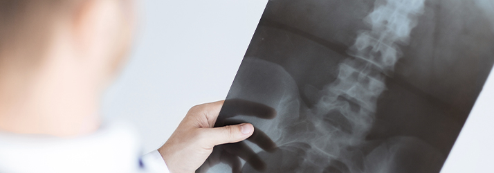 Doctor looking at a x-ray scan